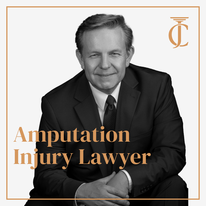 Amputation Injury Lawyer
